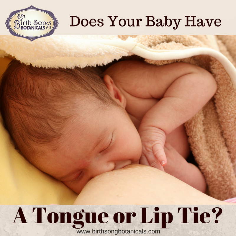 Breastfeeding With A Lip Tie or Tongue Tie