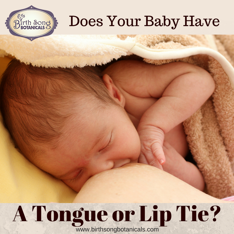 Breastfeeding A Baby with Tongue or Lip Tie