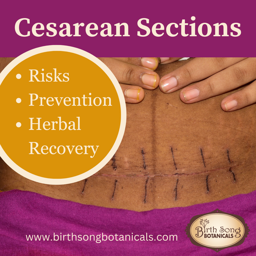 Cesarean Sections: Risks, Prevention, and Herbs for Recovery