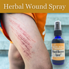 wound recovery spray, herbal wound care, calendula for wounds, St. John's Wort for healing, lavender wound spray,  minor cuts and scrapes treatment, burn relief spray, herbal burn treatment, sunburn relief spray, natural first aid, skin repair spray, natural burn relief, cuts, healing burns, skin healing, skin repair