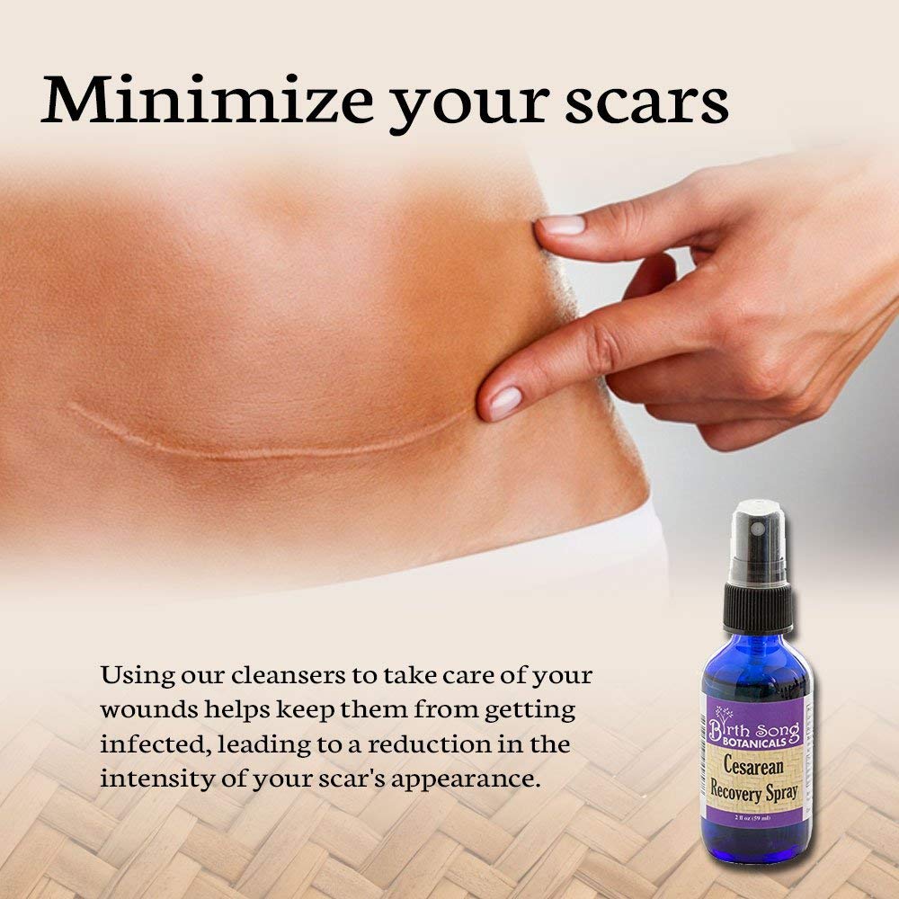 Cesarean Recovery Organic Herbal Antiseptic Spray minimize scars